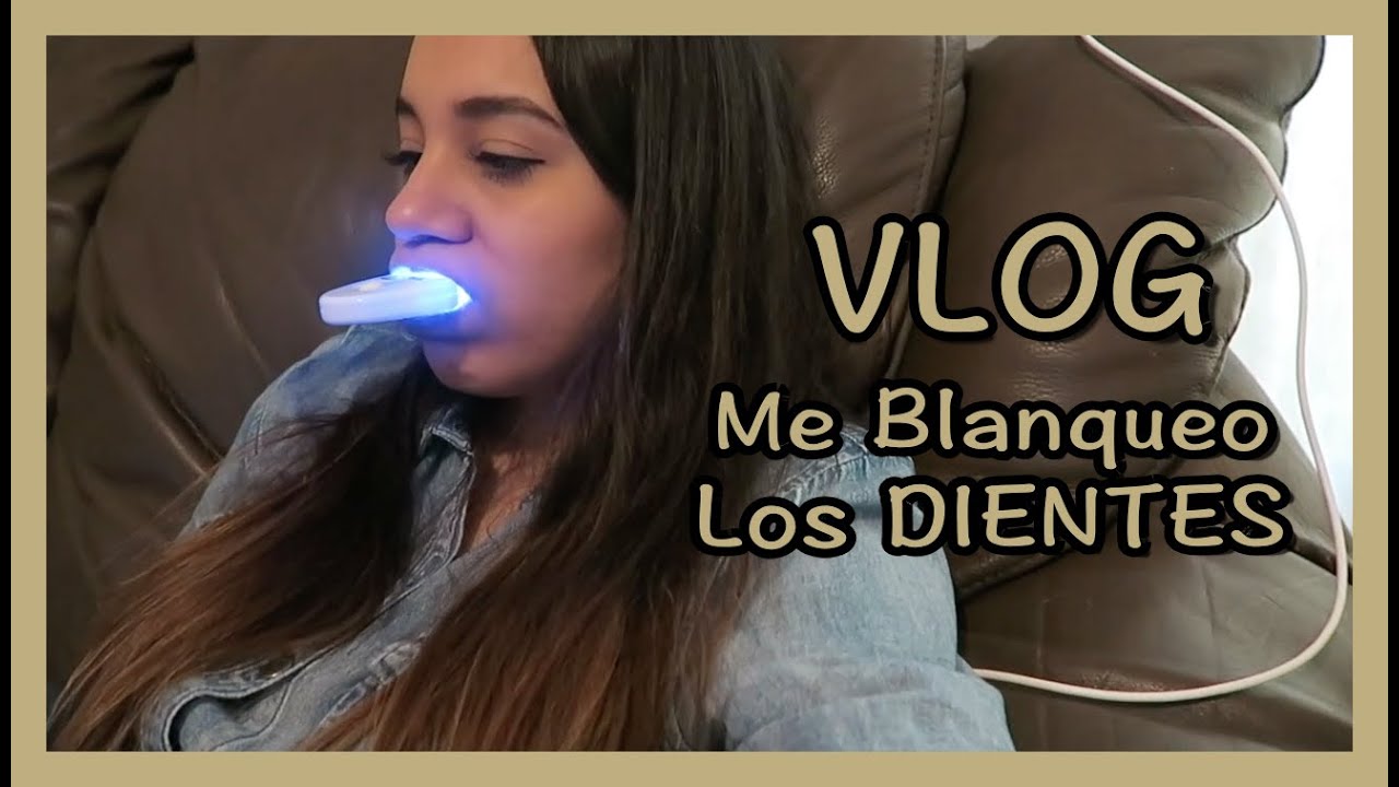 Vlog - Me Blanqueo los Dientes y MamaChuy me Gana la Chamba.