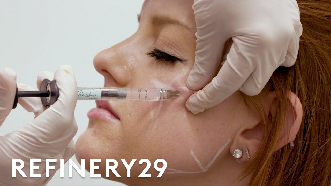 I Got Plastic Surgery To Look Like Meghan Markle | Refinery29