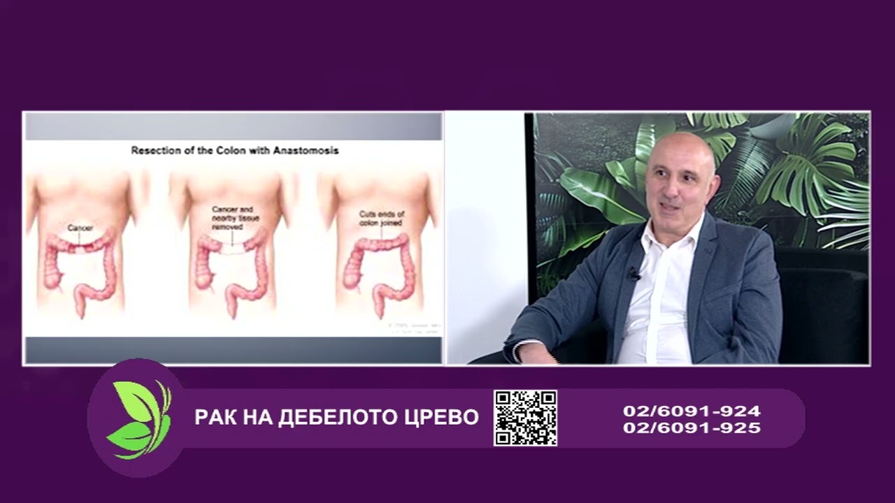 Фактор здравје - Рак на дебелото црево