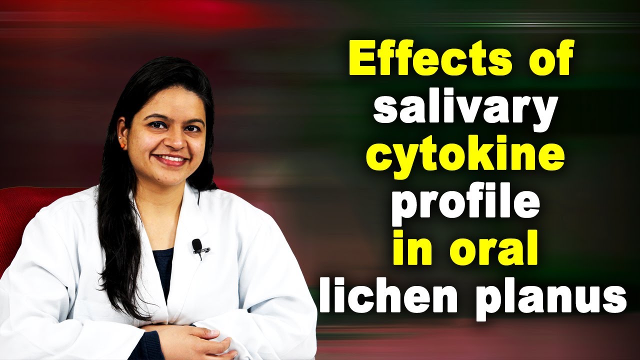 Effects of salivary cytokine profile in oral lichen planus