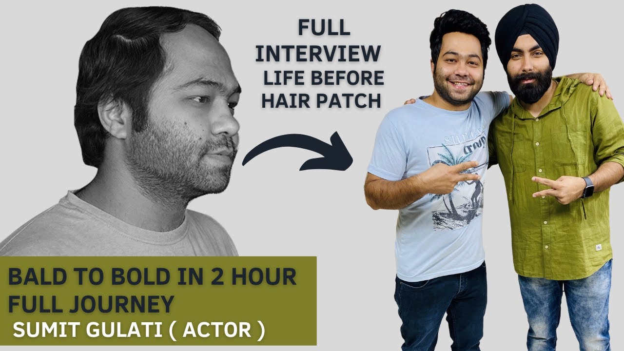Bollywood Actor | Full Interview | Hair Patch in 2 Hour @Hairwighouse  9953384242
