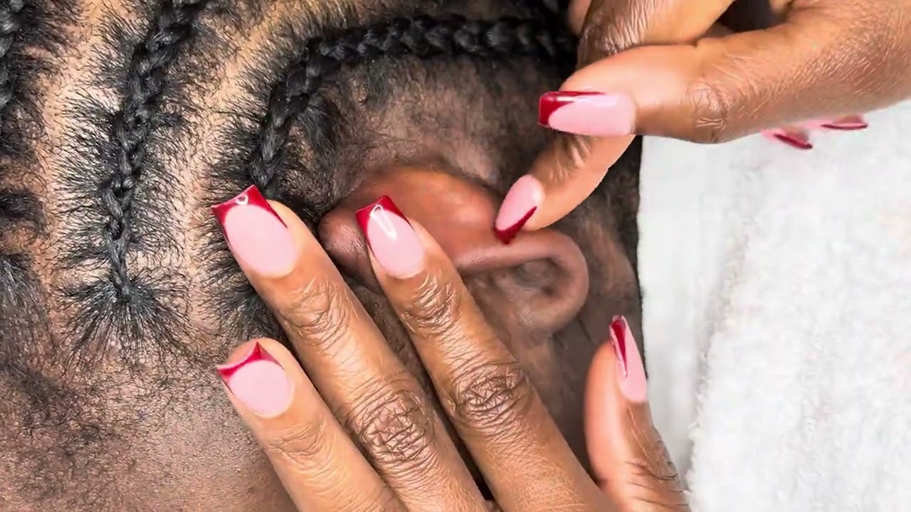 Super Attentive ASMR Nitpicking for Sleep 😴 