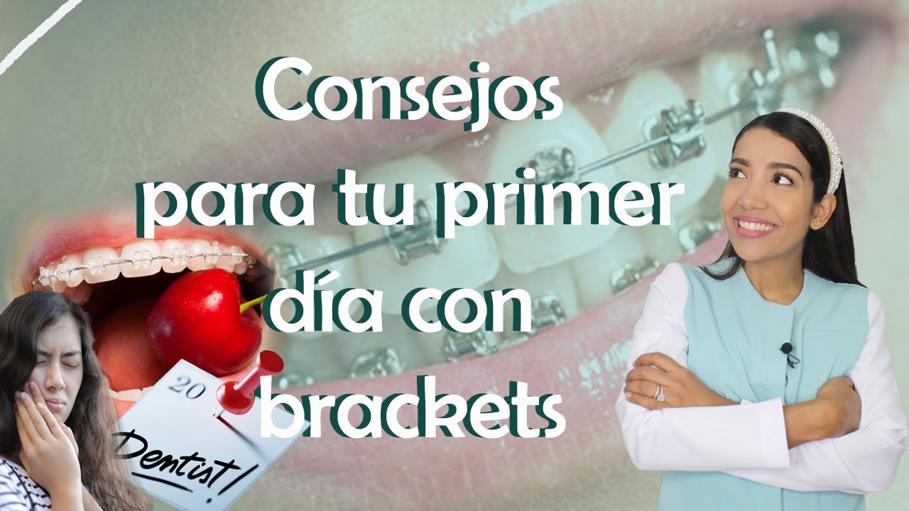Primer día con BRACKETS 2023