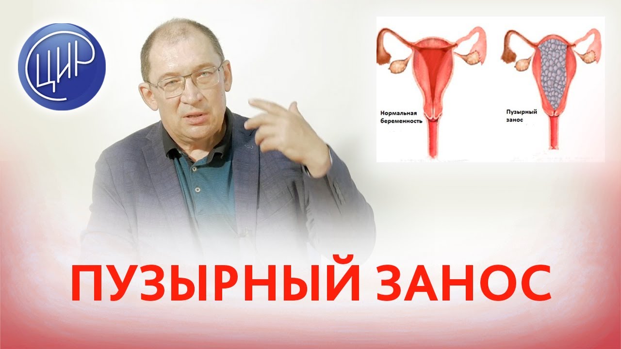 Пузырный занос. Что такое пузырный занос. Гузов И.И.