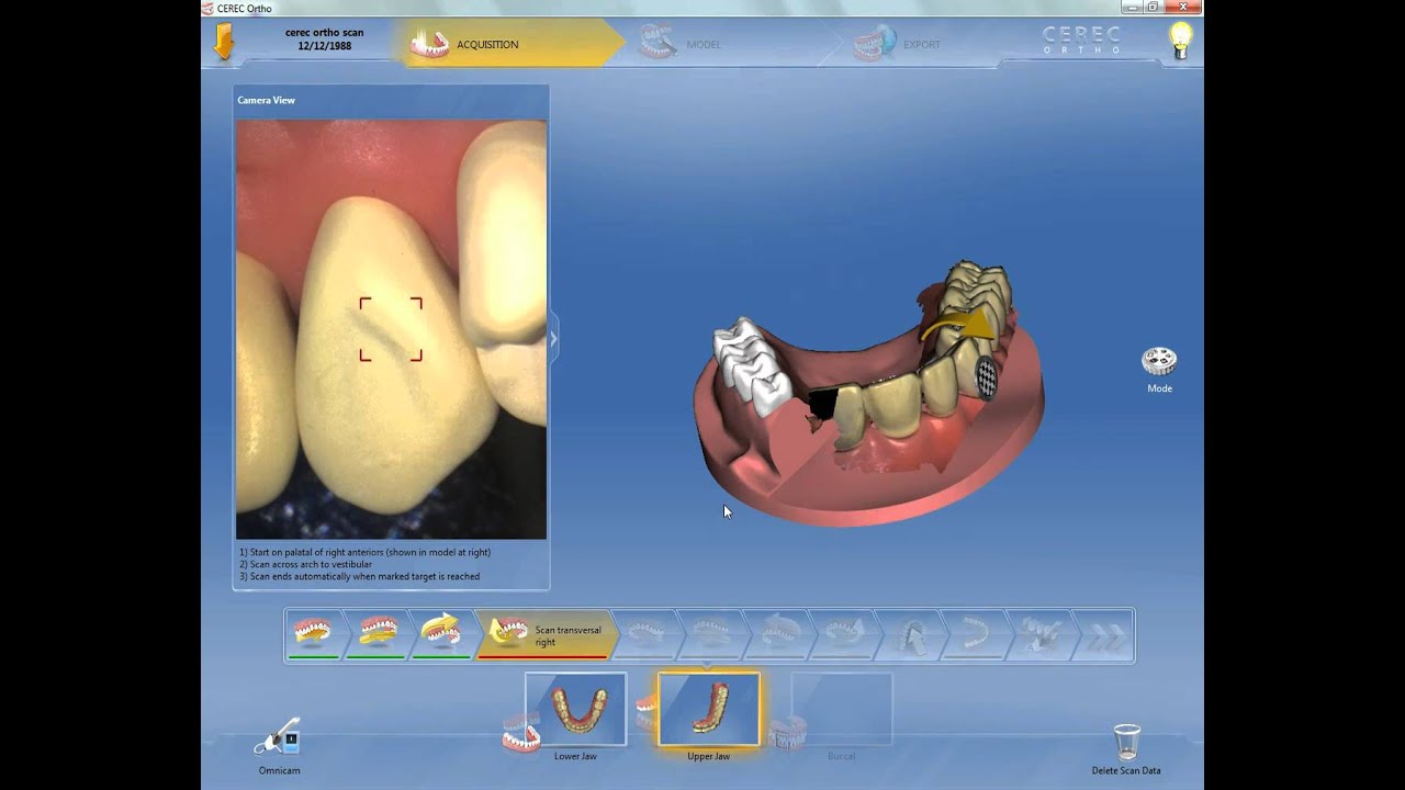 CEREC ORTHO 1.1