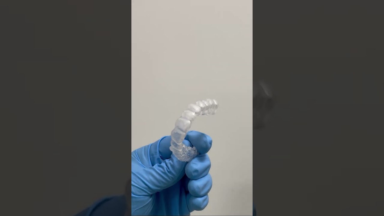 CONTENZIONE ORTODONTICA #dente #dentista #dentist #ortodonzia #orthodontics #odontoiatra #aligners