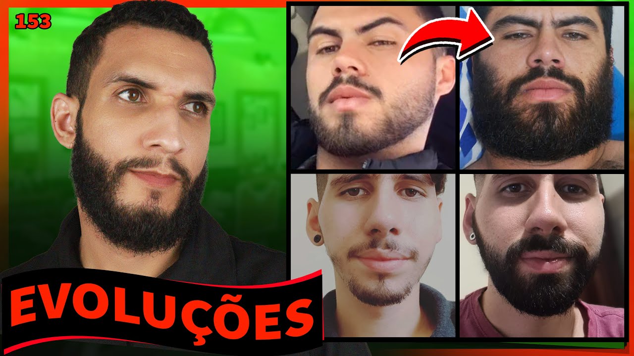 EVOLUÇÕES  COM MINOXIDIL (resultados dos inscritos) - 153