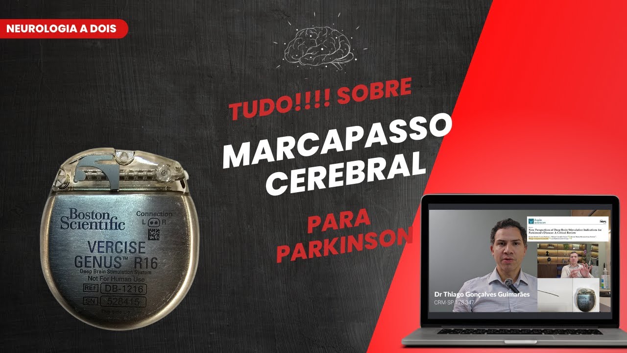 MARCAPASSO CEREBRAL no Parkinson em 2024: Por que n&atilde;o para todos? Para quem &eacute; indicado?