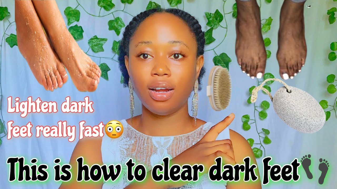 HOW TO GET RID OF DARK FEET👣DISCOLORATION + *Lighten Dark Body Parts* Dark feet *Black toe* | Ankle