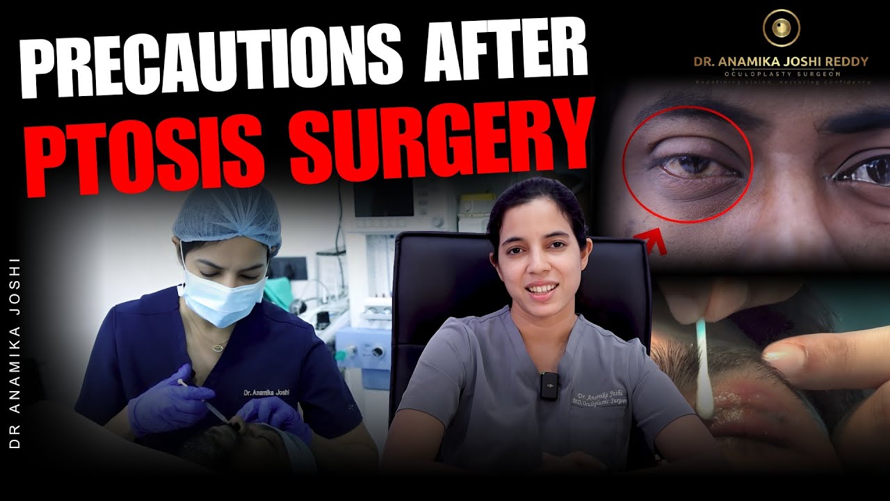 Ptosis surgery के बाद क्या सावधानी रखे? | Precautions after Ptosis surgery | Dr Anamika Joshi