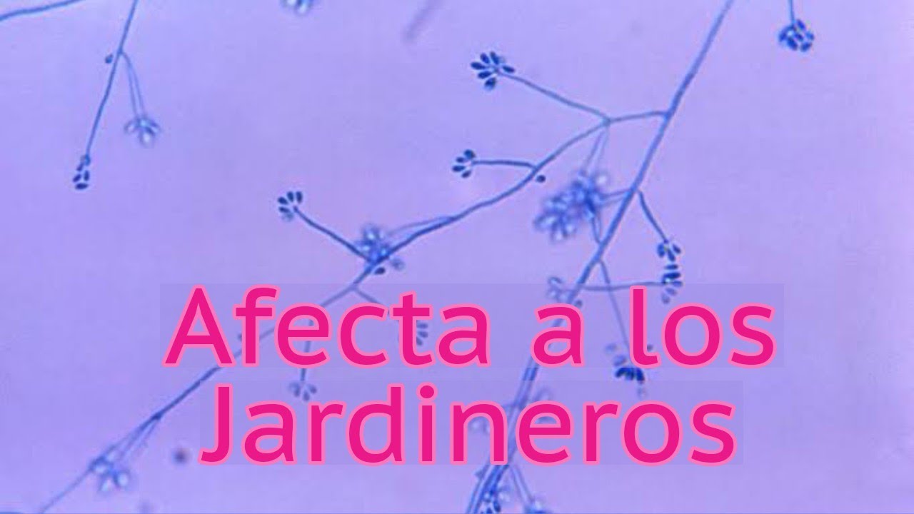 Una Cortada Causa Úlceras Dolorosas | Sporothrix schenckii  Curso de Micología Médica