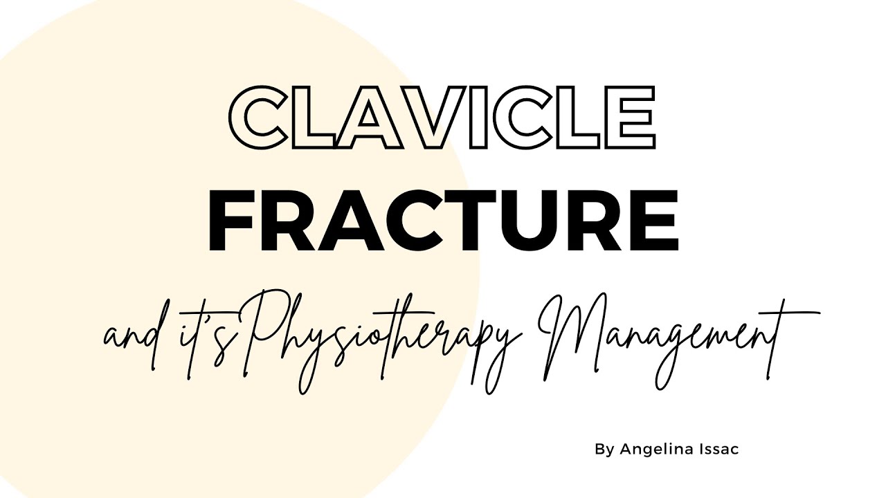 Clavicle fracture & its Physiotherapy Management