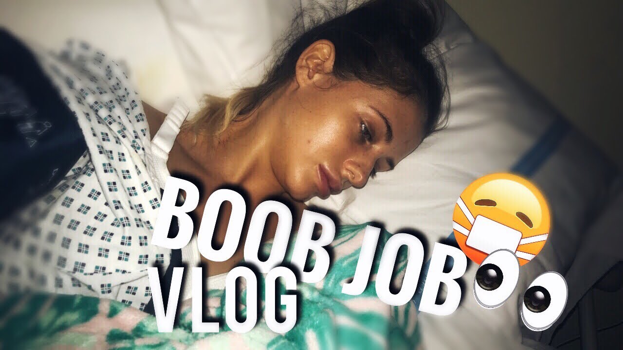 BOOB JOB VLOG #1 👀