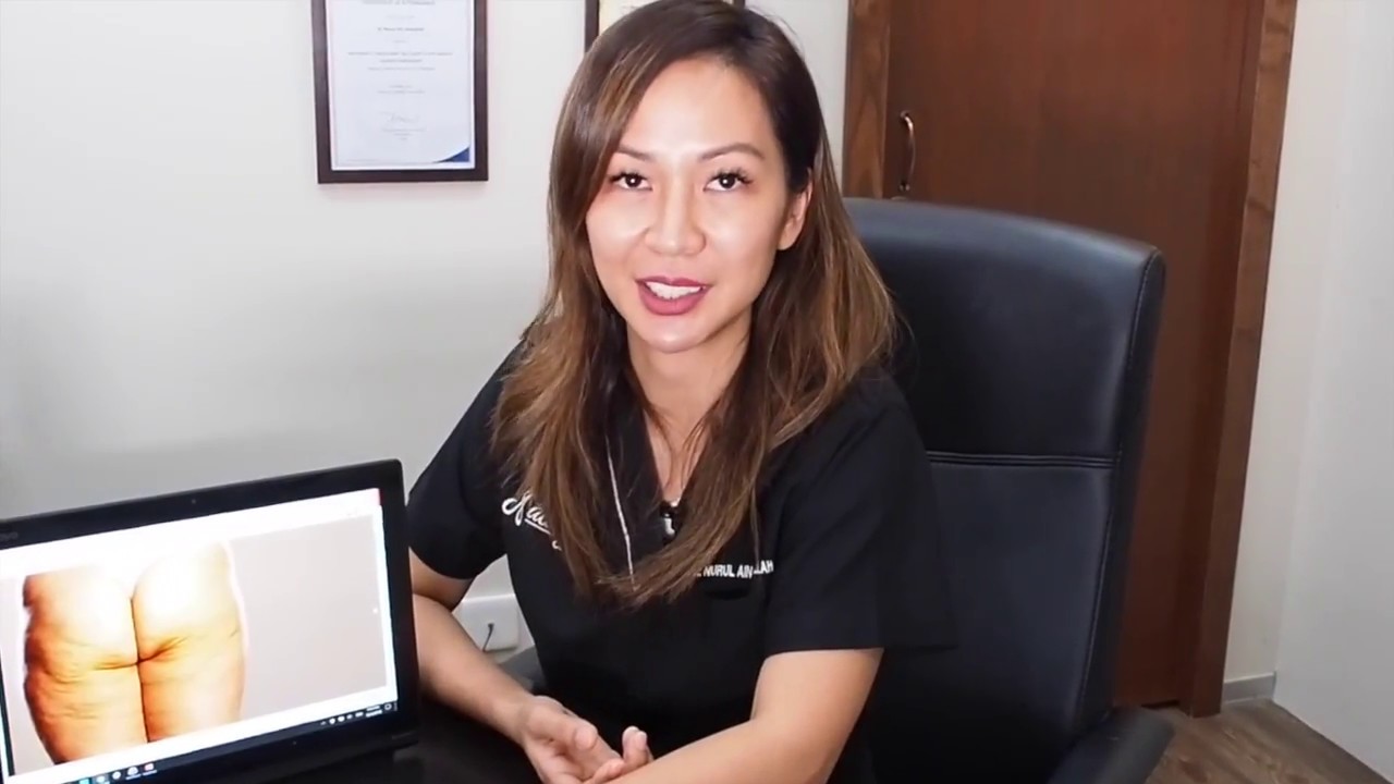 Cellulite Treatment