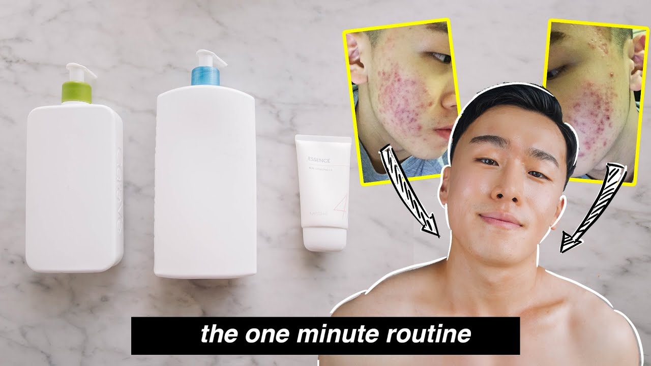 mens simple skincare routine: how I cured my cystic acne