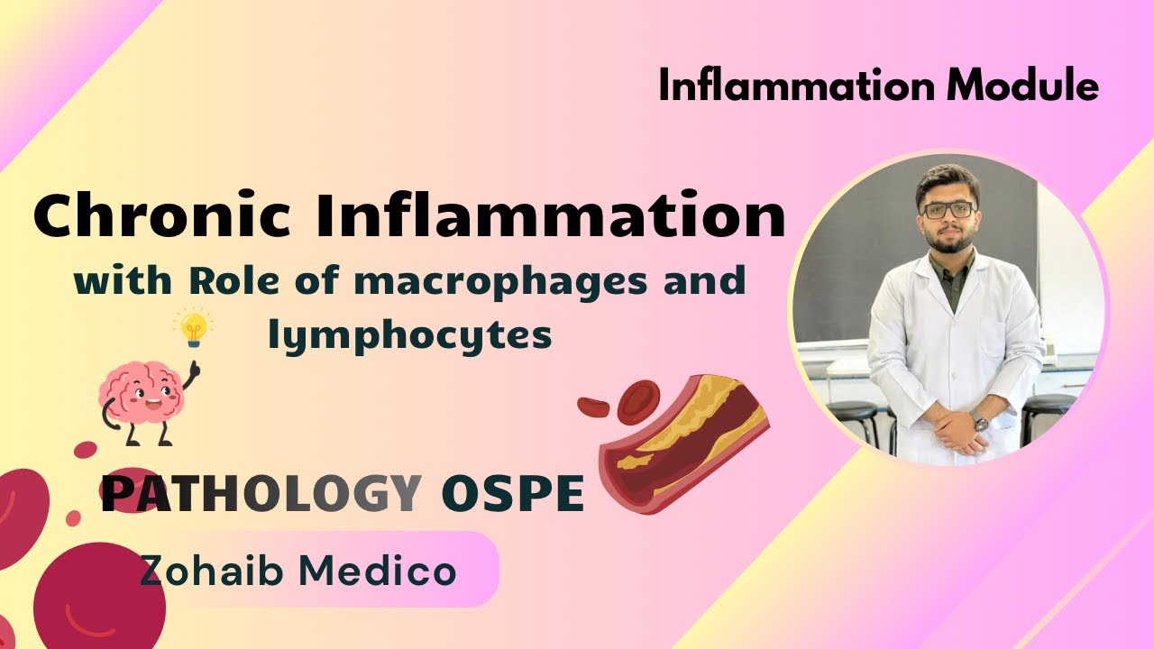 Chronic Inflammation | Role of macrophages and Lymphocytes | Pathology | Inflammation 