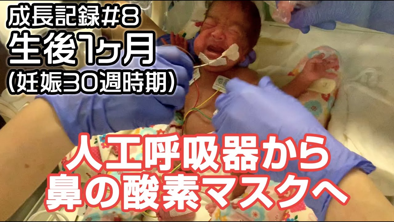 【成長記録 #8】生後1ヶ月赤ちゃん（妊娠30週時期）人工呼吸器から鼻の酸素マスクへ （NICU 22週早産 572g）