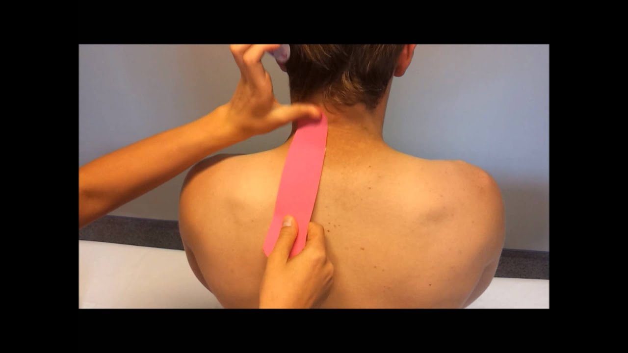 Tejpování krční páteře - kinesiotaping