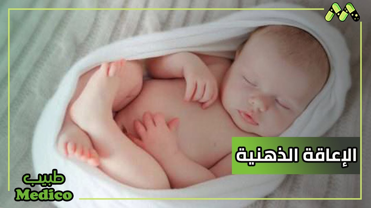 نقص الأكسجين أم الأمراض الوراثية التي ممكن أن تسبب في حدوث إعاقة ذهنية للجنين مع د. حسن صلاح
