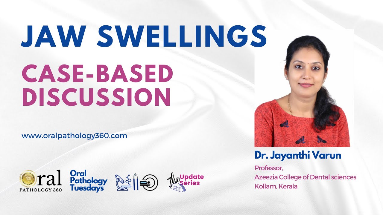 Oral Pathology | Jaw swellings- Case based discussion