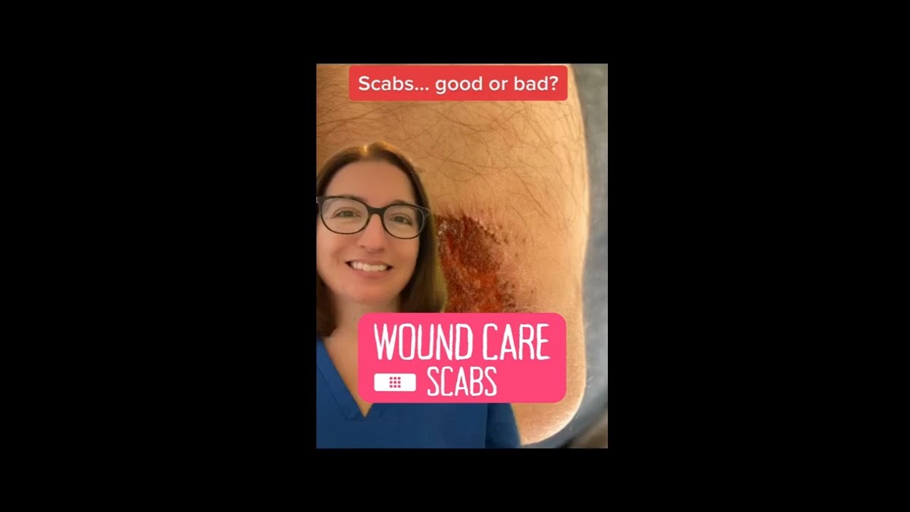 Scabs: Wound Care | @LevelUpRN
