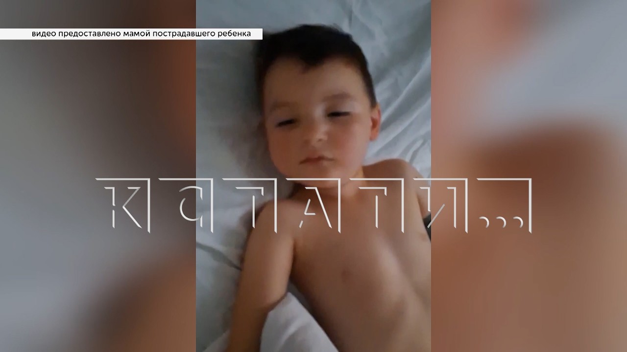 4-year-old child in intensive care with brain edema due to the negligence of Arzamas doctors