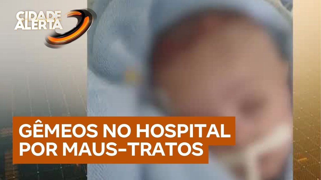 Bebê de 2 meses morre após dar entrada no hospital com queimaduras e fraturas