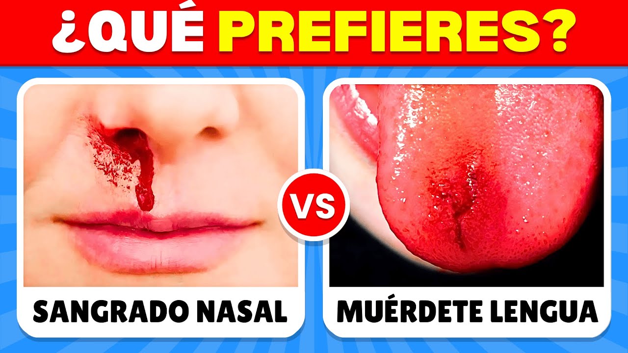 ¿Qué Prefieres? ¡EDICIÓN EXTREMA! ✅🤔❓ ¡Las Decisiones Más Difíciles de Tu Vida! | Ele Quiz