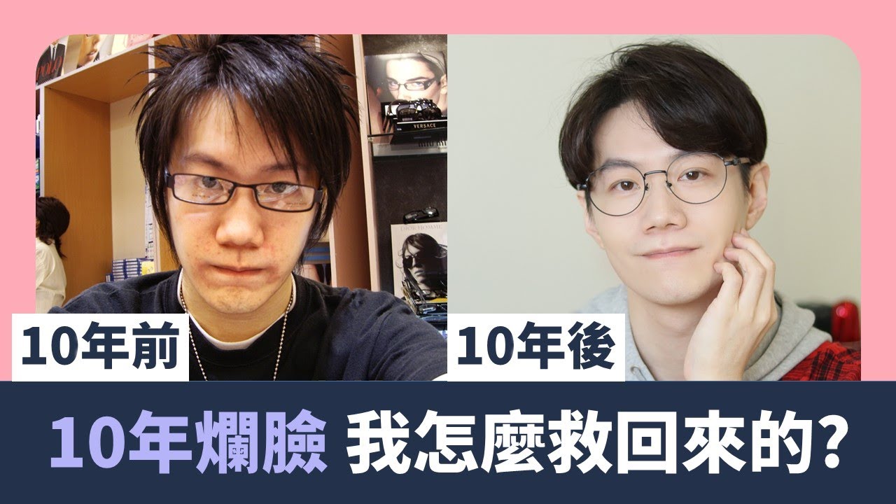 分享10年前為何爛臉? 皮膚怎麼恢復健康的?