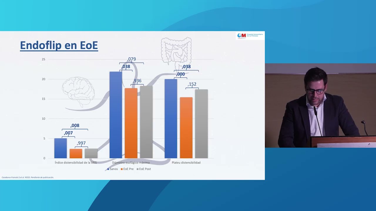 Esofagitis eosinofílica. Dr. Sergio Casabona