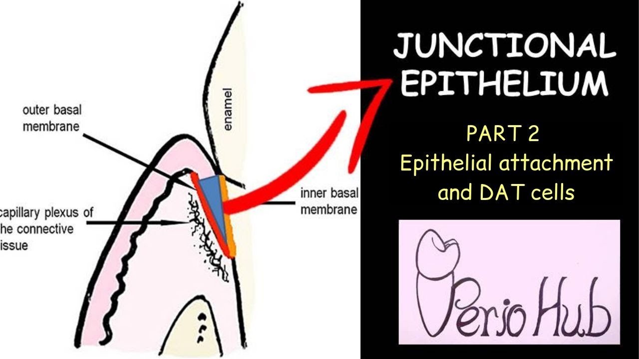 JUNCTIONAL EPITHELIUM (PART 2) II  Epithelial attachment and DAT cells