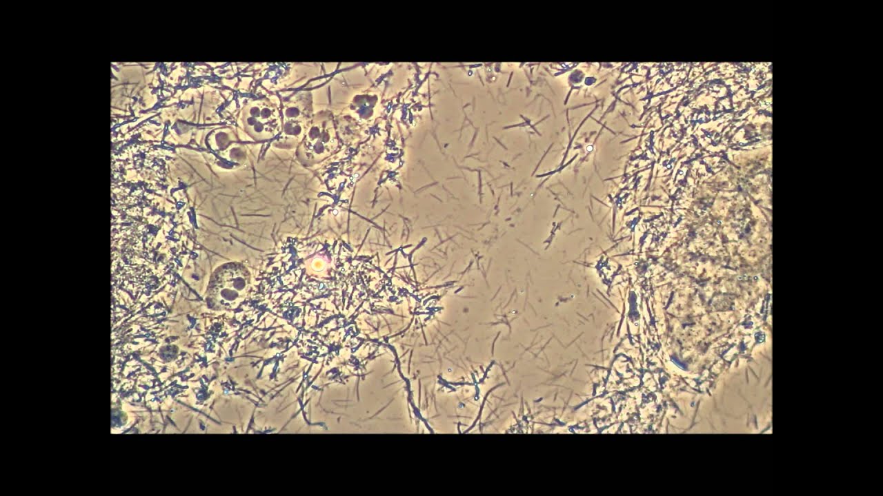 Spirochetes, the wiggly menace causing Gum Disease