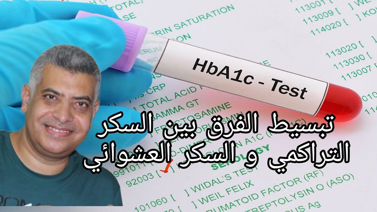 الفرق بين السكر التراكمي و السكر العشوائي ؟