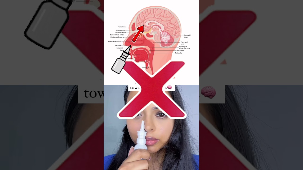 How to use nasal spray correctly? #nasalspray #health #medicine #lifehacks #fyp #viralshorts