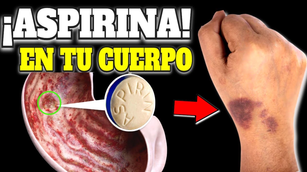 &iexcl;ASPIRINA! C&oacute;mo funciona? - Lo que NADIE te cuenta
