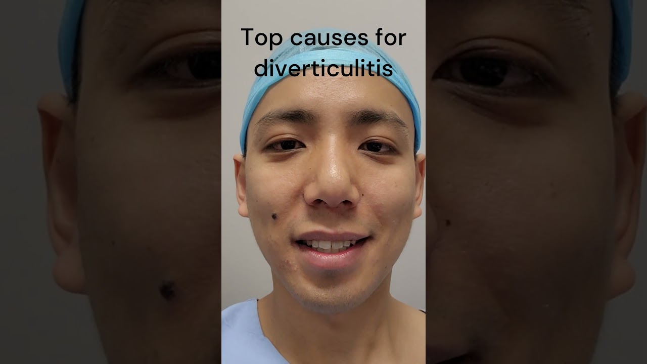 Top causes for diverticulitis. #surgery #diverticulitis