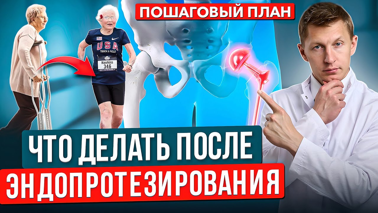 Как быстро стать на ноги после замены тазобедренного сустава. Реабилитация после эндопротезирования.