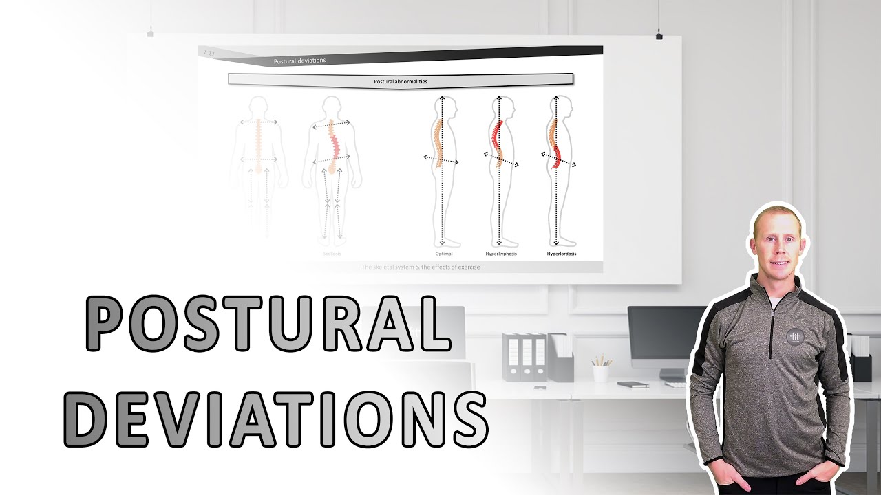 Postural deviations