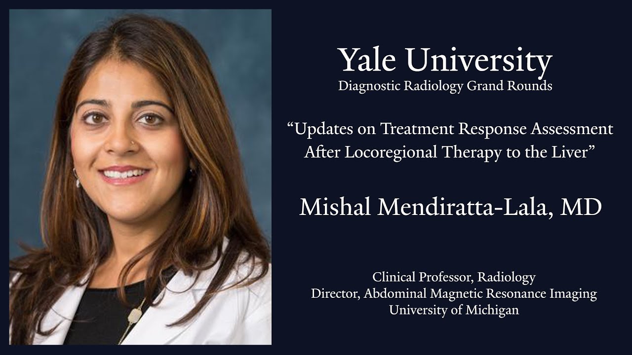 Updates on Treatment Response Assessment After Locoregional Therapy to the Liver