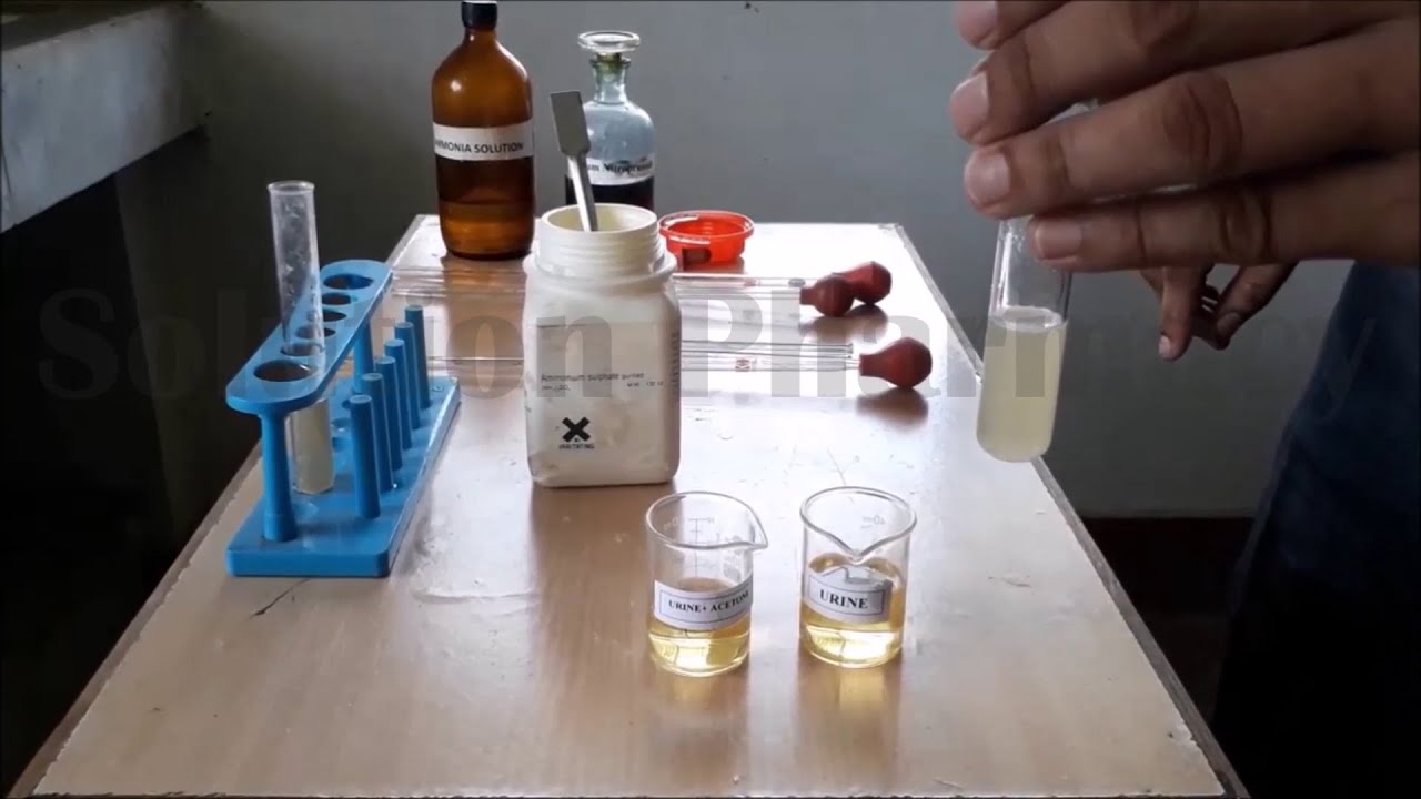Urine Analysis for Abnormal Constituent| Detection of Urine Ketone Bodies | यूरिन टेस्ट फॉर कीटोन