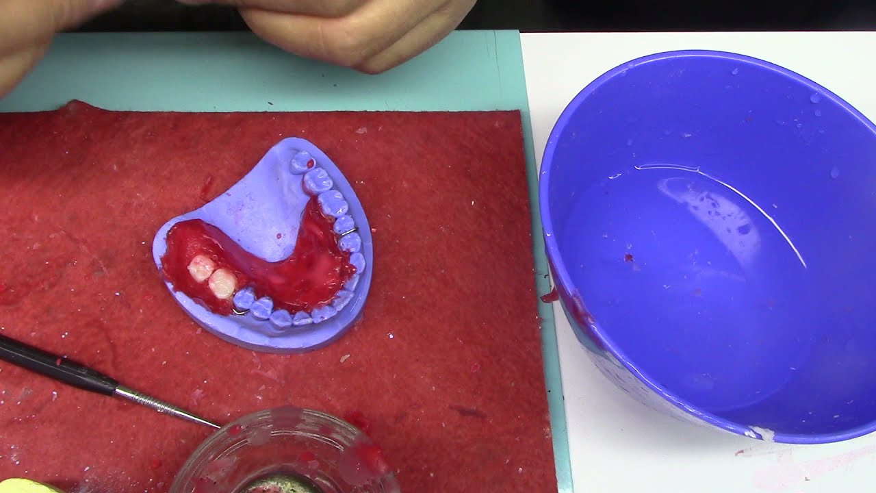 setting and wax rim for partial denture د.عبد القادر