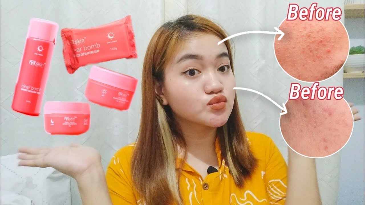 CLEAR BOMB 1 MONTH EXPERIENCE✨ (Ryx skin Sincerity) ♡