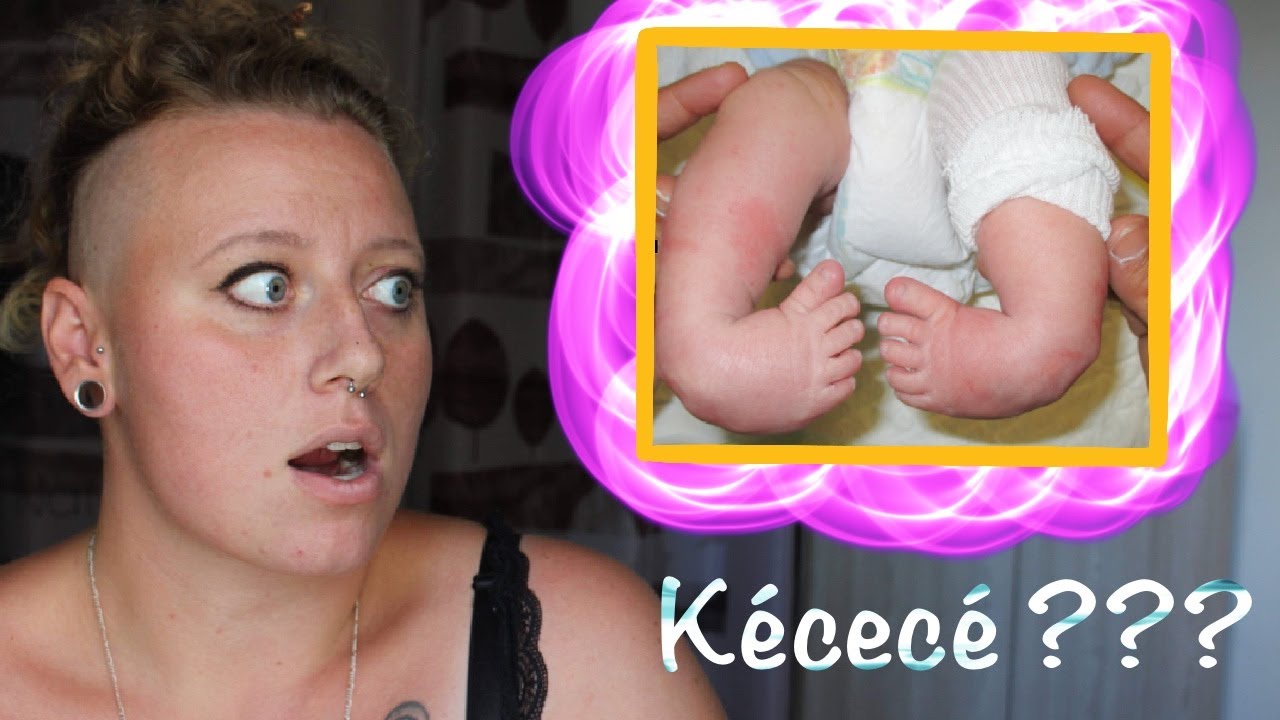NOTRE FILLE VA NAITRE AVEC LES PIEDS BOTS ► TROTTINETTE&BINETTE