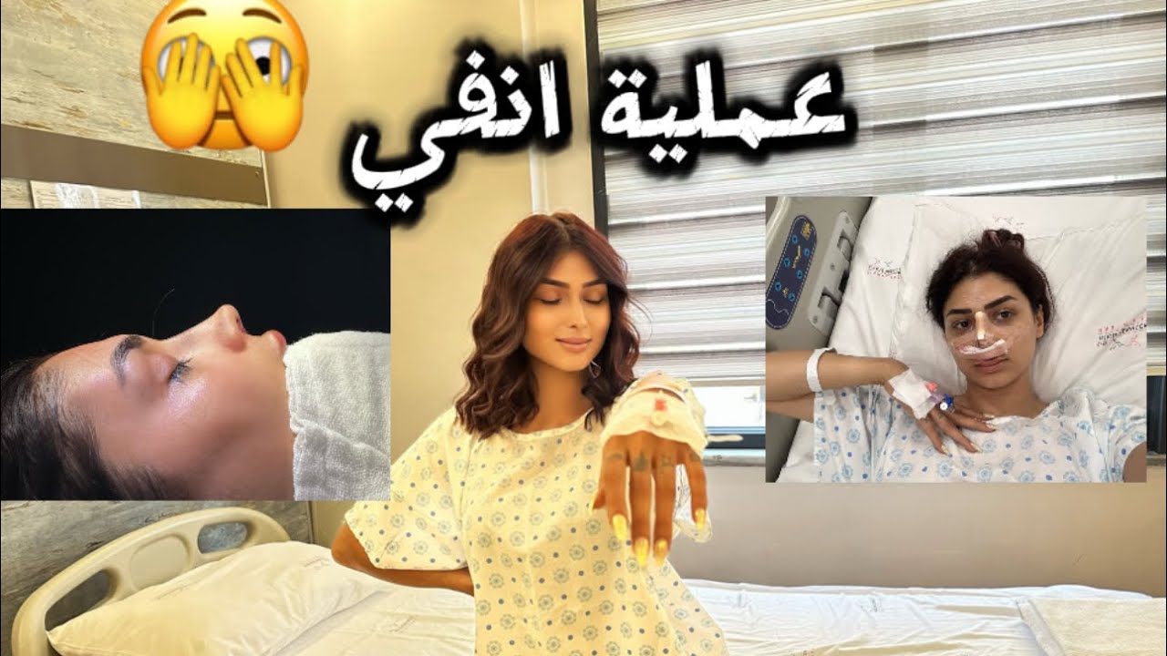 فلوق عملية تجميل انفي 👃🥺ضليت يوم كامل بالمشفى