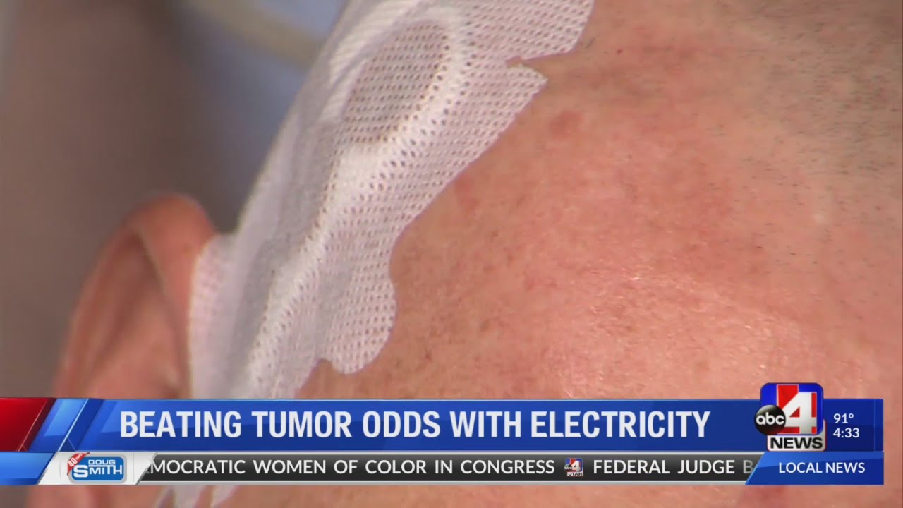 Electricity helps control man&rsquo;s brain tumor