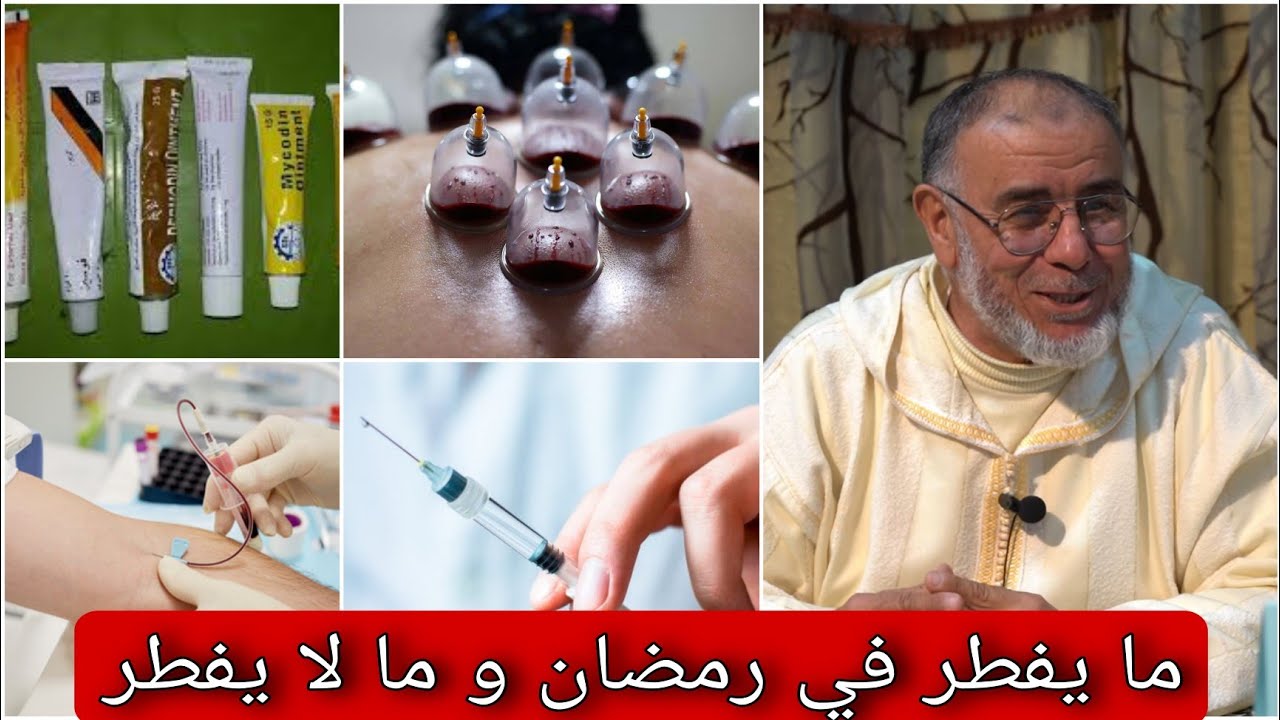 الشيخ عبد الله نهاري ما يفطر و ما لا يفطر عبر الجلد : الإبر ؛ سحب الدم و الحجامة ؛ الحناء ؛ المراهم