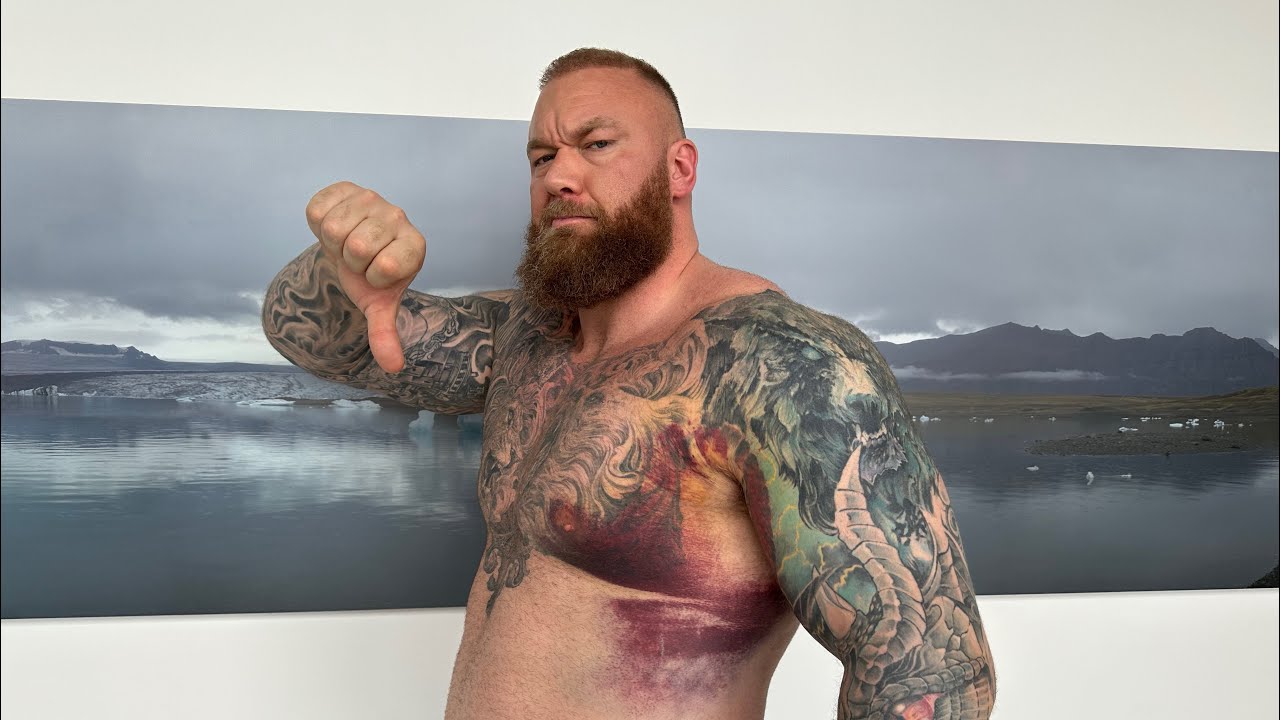DOCTOR EXPLAINS PEC TEAR