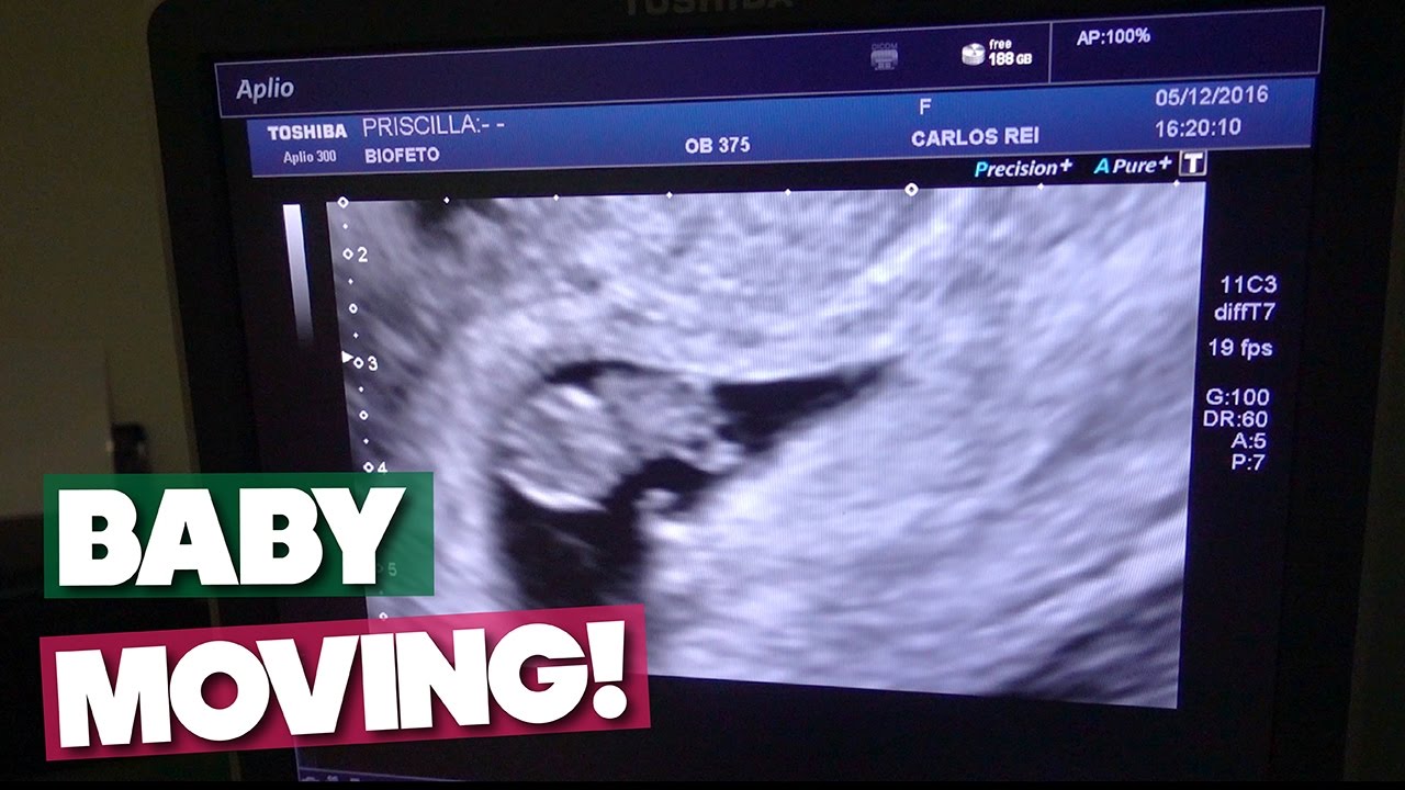 8 WEEK ULTRASOUND! BABY ALREADY MOVING!!!