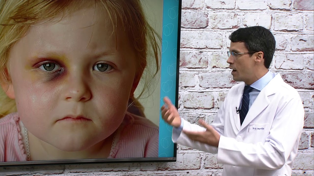Saiba tudo sobre Traumatismo Cranioencefálico