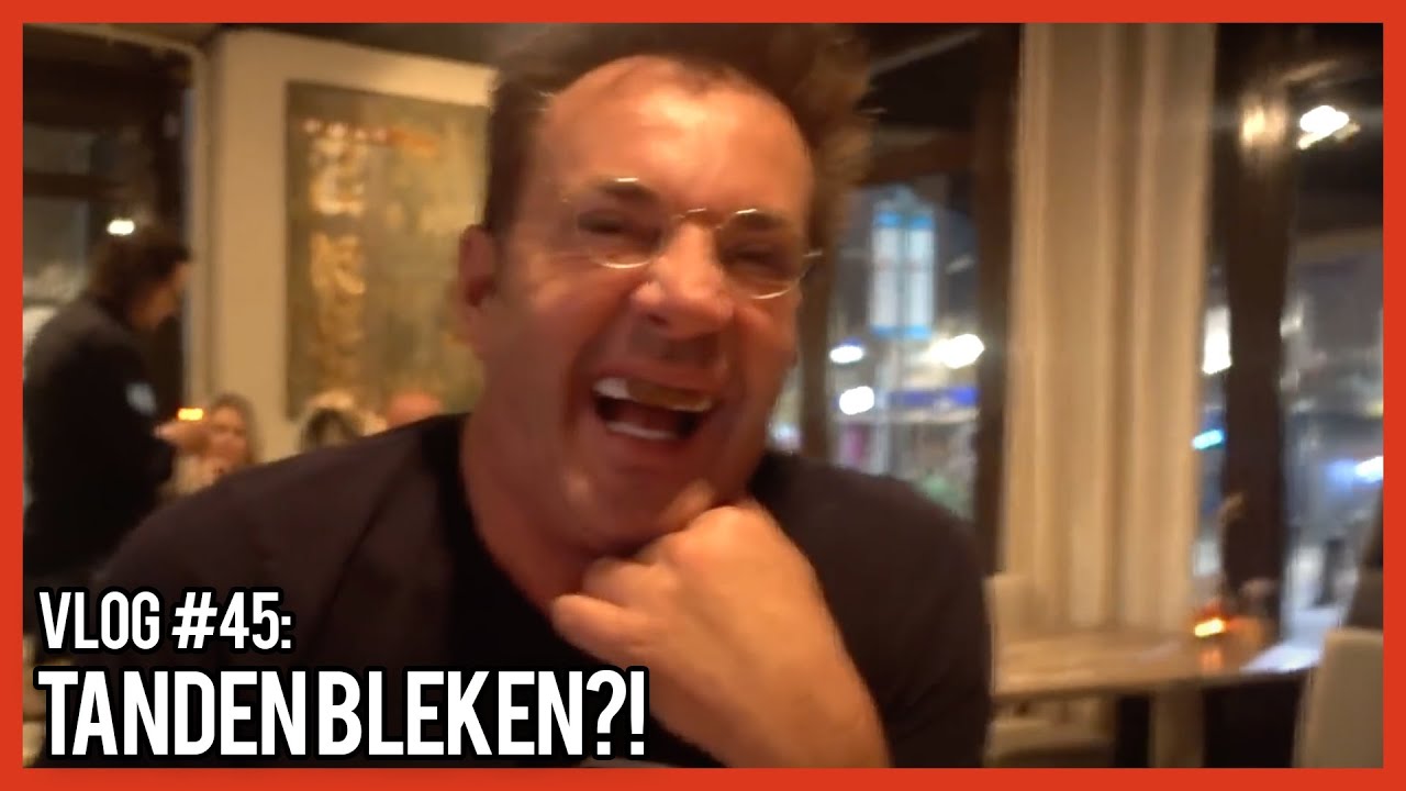 TANDEN BLEKEN?! - GERARD JOLING - VLOG #45